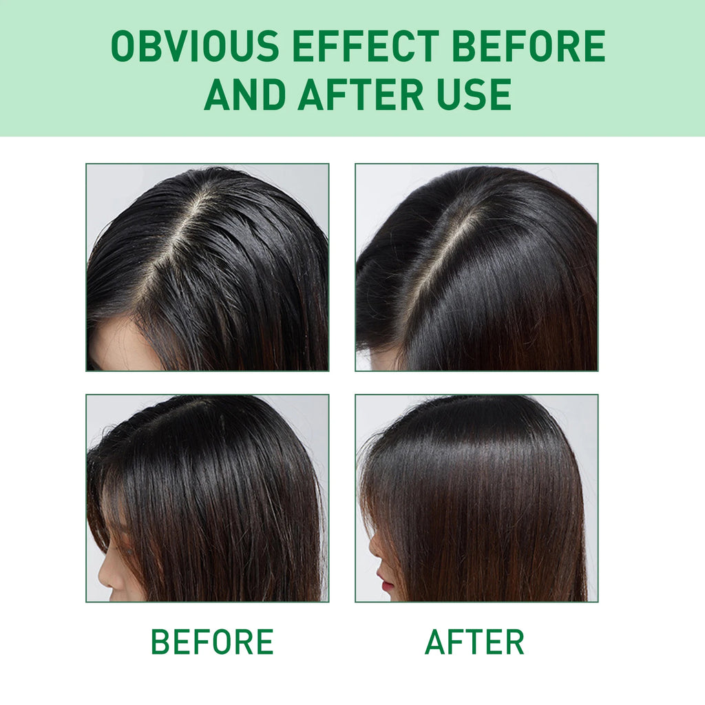Fluffy Volumizing Hair Spray Oil Control Refreshing Absorb Grease Clean Scalp Air Feeling Wash-Free Dry Shampoo Styling Mousse